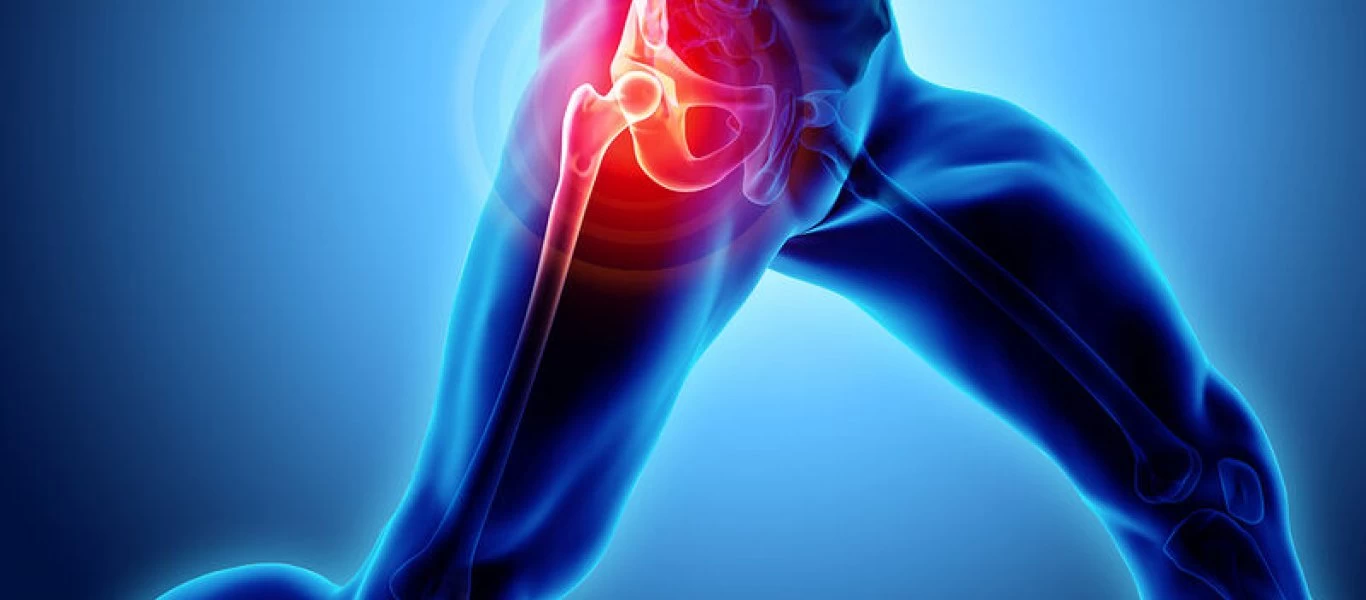 Πόσο βοηθάει η ολική αρθροπλαστική στο κάταγμα ισχίου;